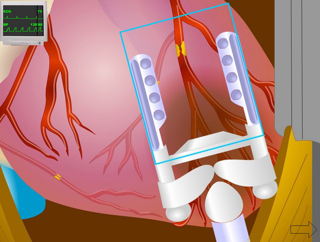 Surgery Animation
